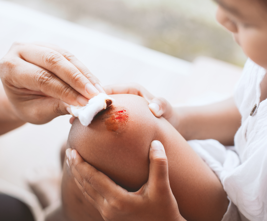 boy with wound on his knee